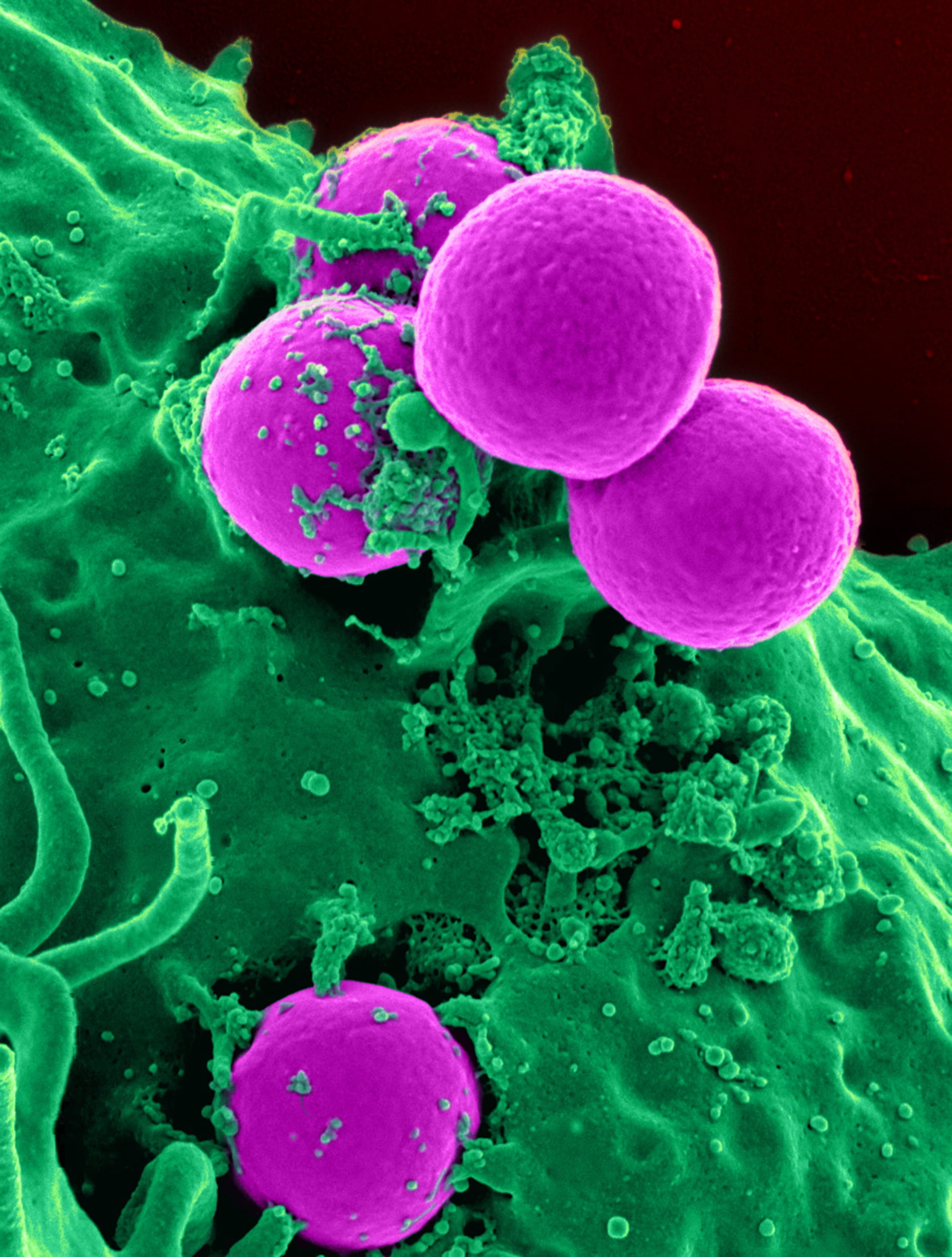 purple and green micro bacteria, white blood cell, human, electron microscope
