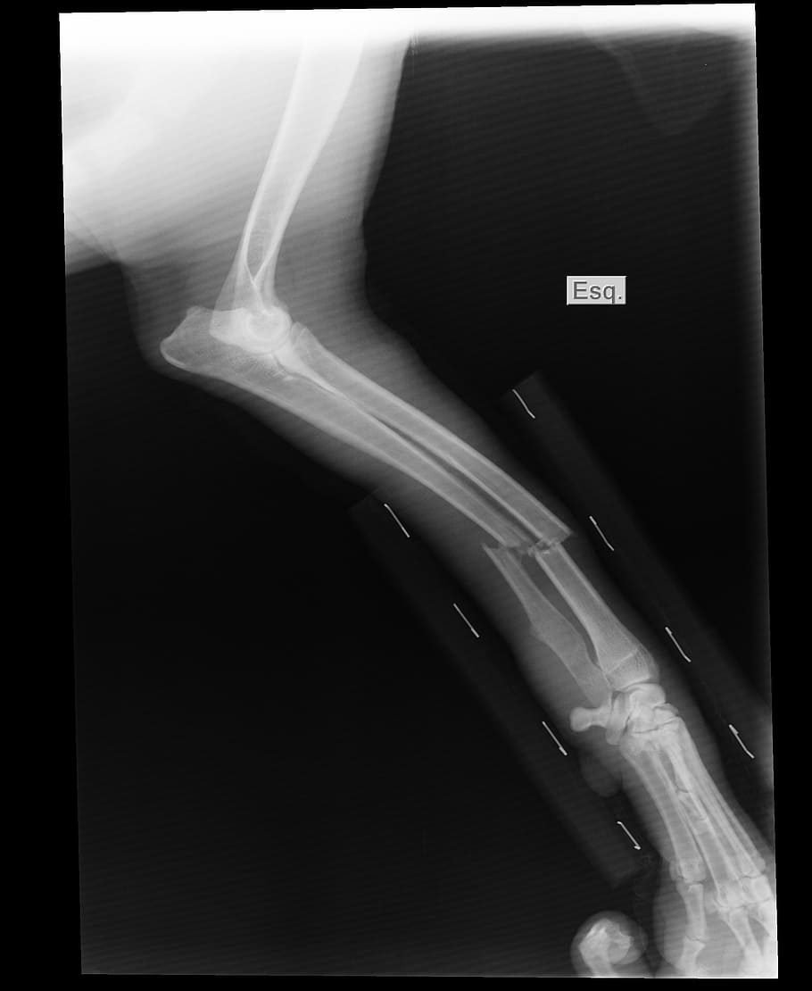 animal x-ray screenshot, broken arm, shin, english pointer, x-ray Image, HD wallpaper