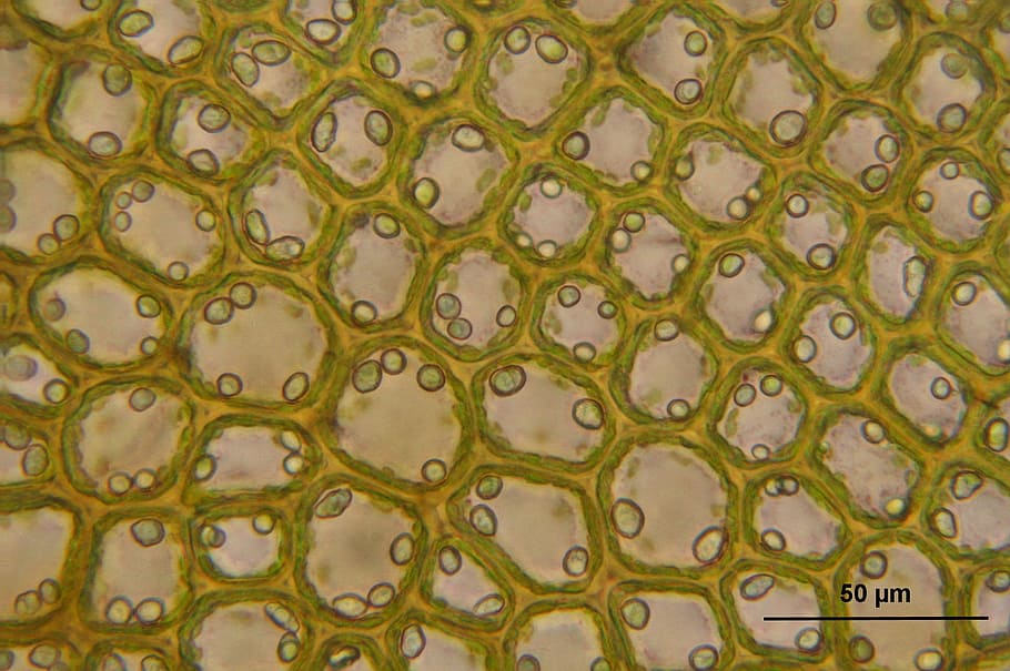 microscopic view of green and white cells, bazzania tricrenata