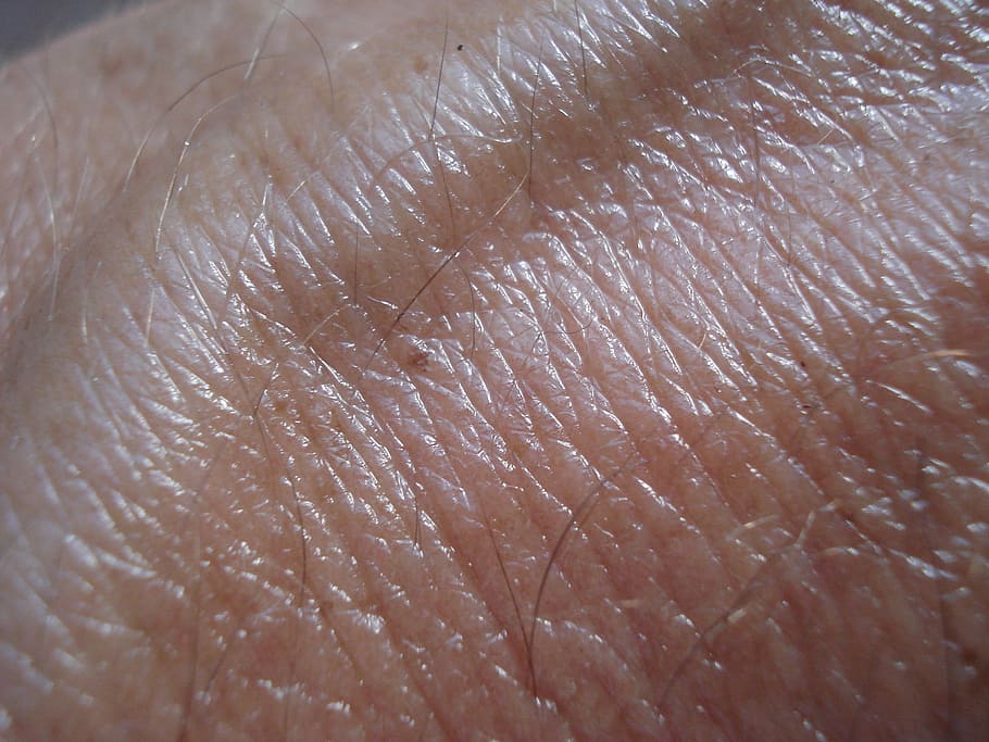 person's skin condition, vein, brown, skin cancer, human, human body part, HD wallpaper