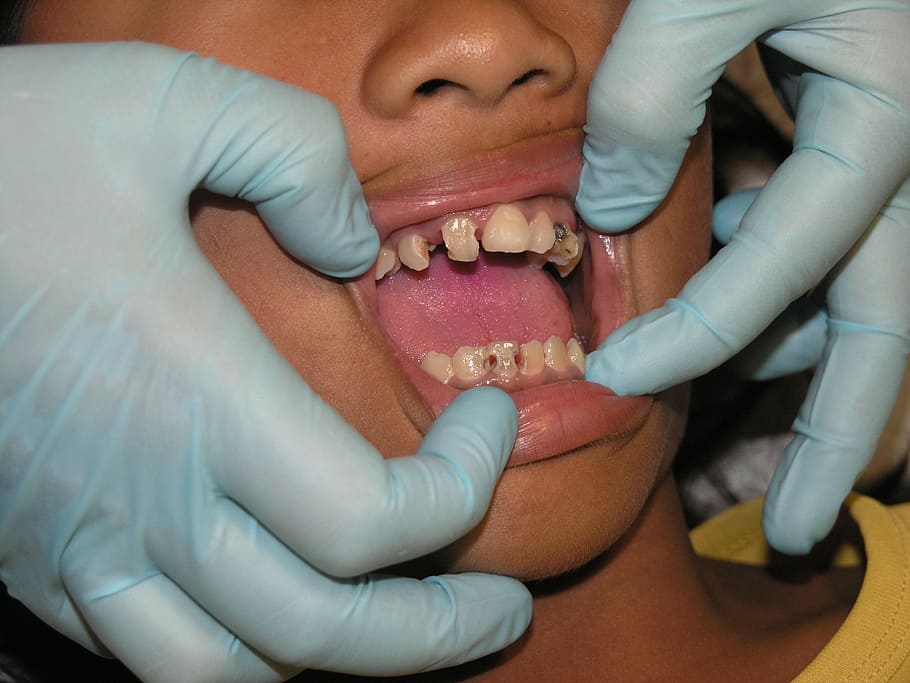dental treatment hd
