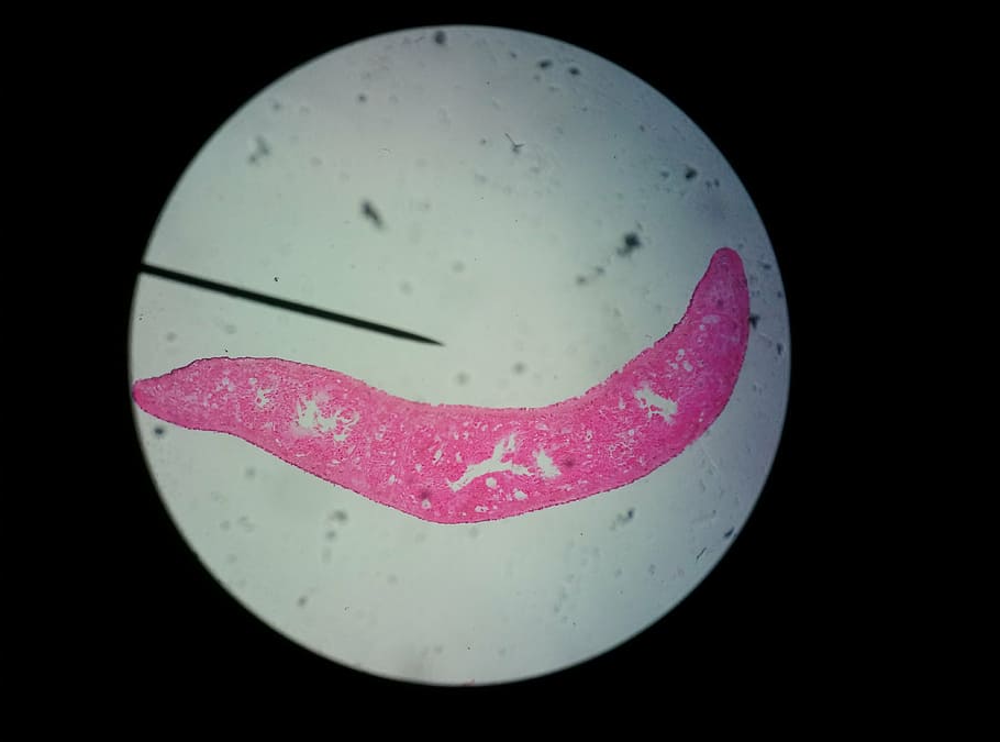 plant, microscope, science, cell, fermenting microorganism HD wallpaper