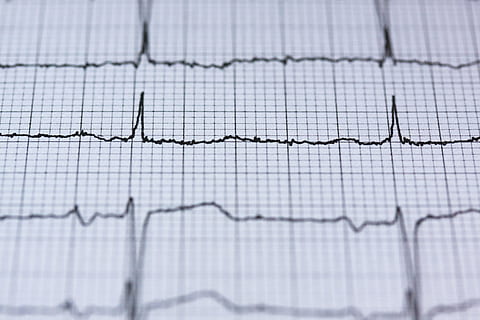 heart, curve, blur, health, chart, check-up, data, diagram, ecg HD wallpaper