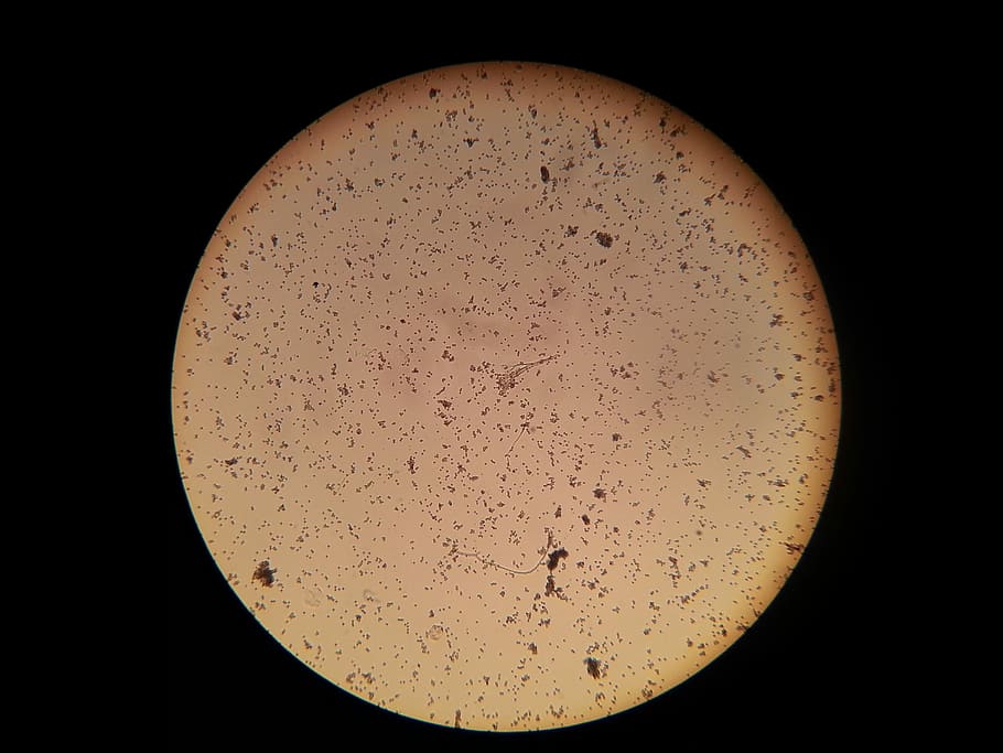 Bacteria, Microscope, Microscopic, Image, microscopic image HD wallpaper