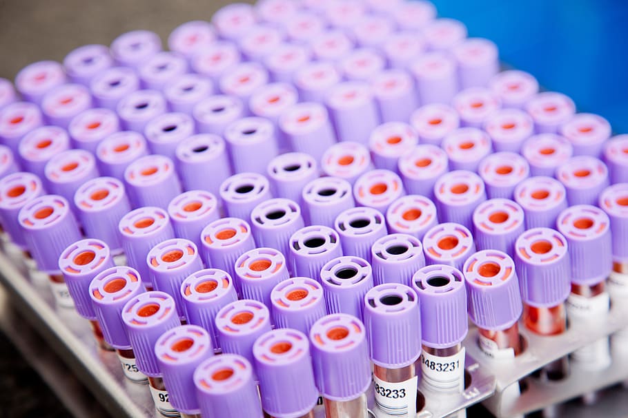 lab, samples, tubes, scientific experiment, large group of objects HD wallpaper