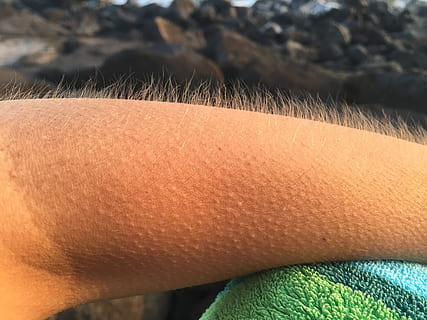 goosebumps, cold, arm, real people, human body part, one person HD wallpaper