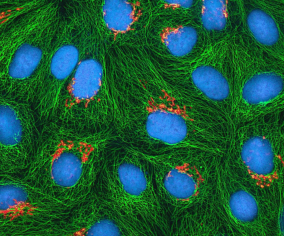hela cells, cultured, electron microscope, stained, fluorescent protein
