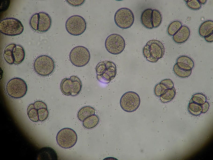 microscopic photo of bacterias, microscopic organism, microscope, HD wallpaper