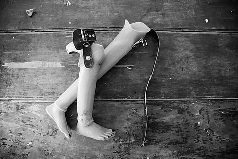 Two Prosthetic Legs on Wooden Surface, abandoned, broken, dark HD wallpaper
