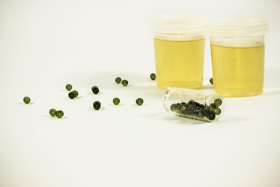 two drinking glasses, the test, urine container, inflammation