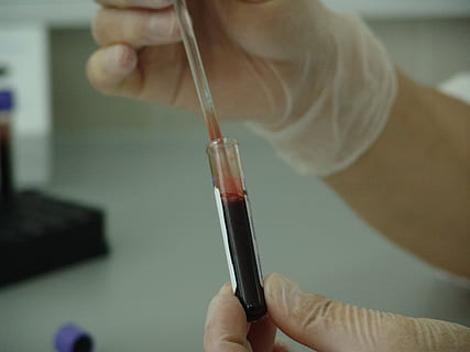 blood biometry