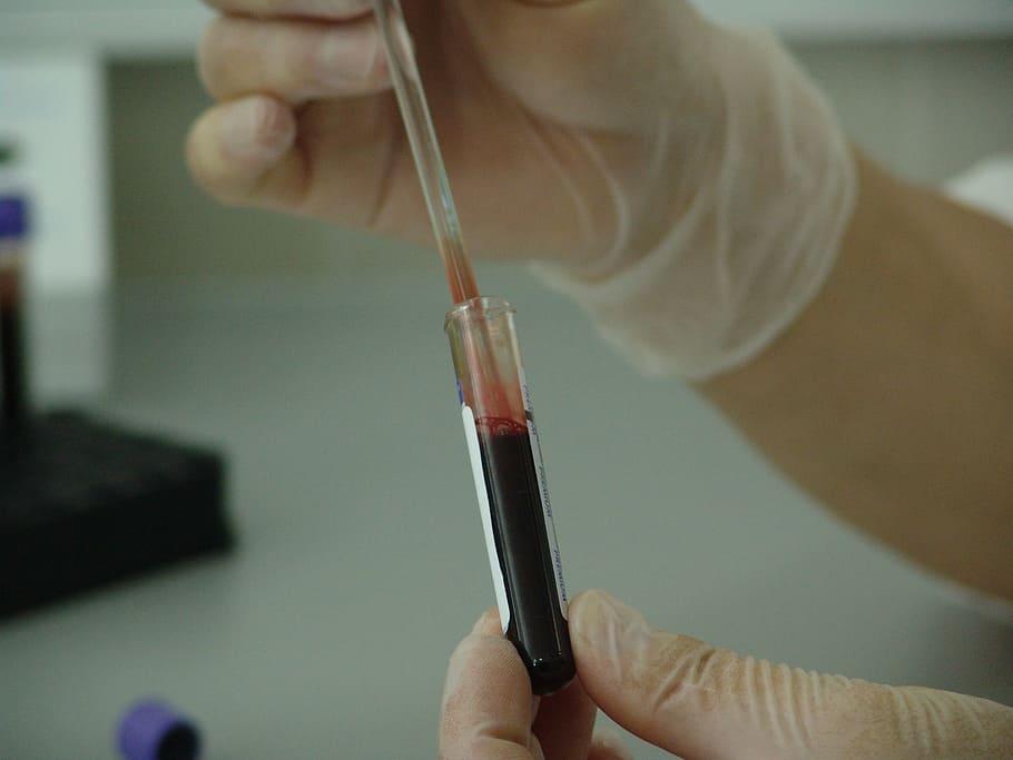 person holding test tube with blood, vial, analysis, laboratory