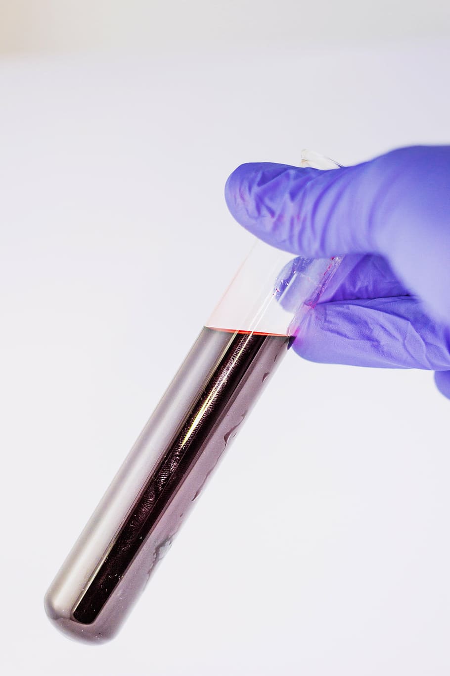 person in purple gloves holding test tube with liquid, blood