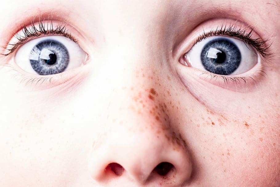 human skin condition, surprised, blue eyes, freckles, see, watch, HD wallpaper