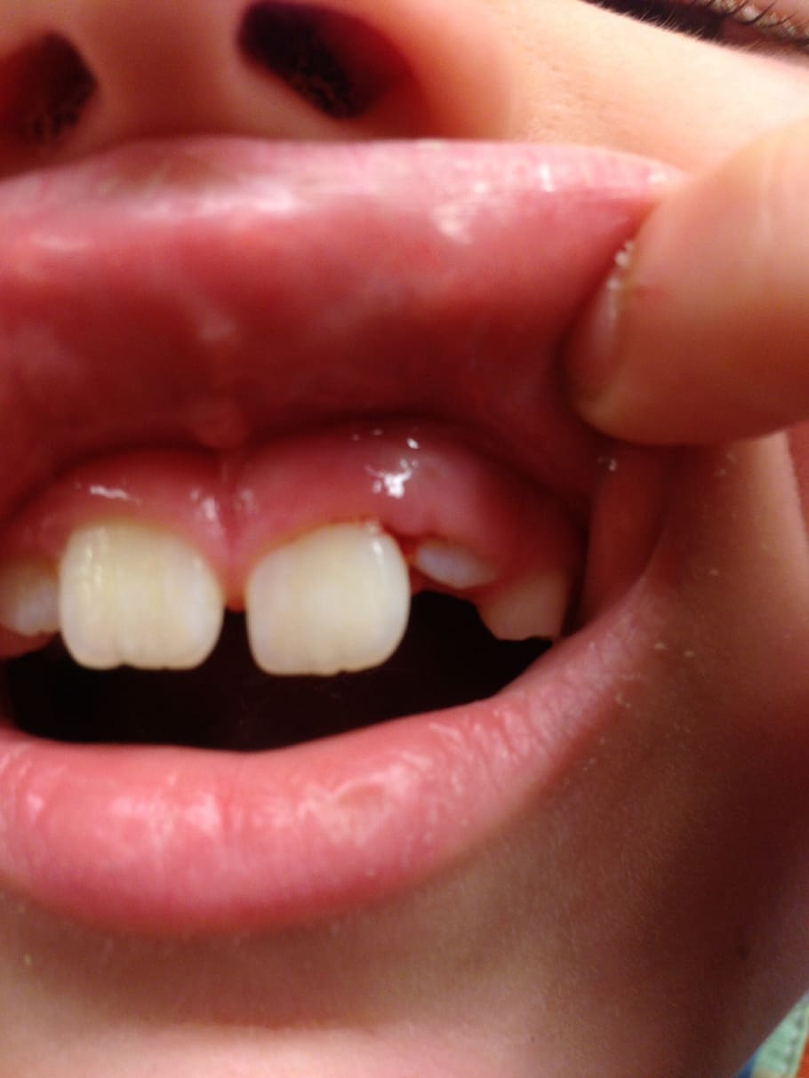 teeth, mouth, dental, human body part, one person, close-up HD wallpaper