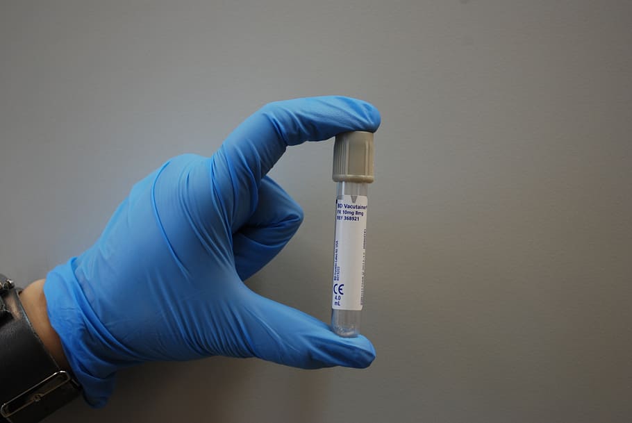 person holding white and gray tube bottle, laboratory, medical HD wallpaper