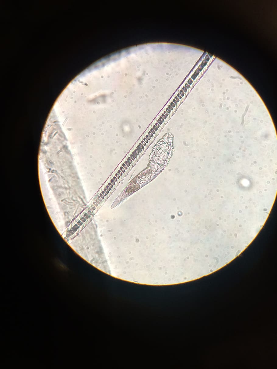 microscope, mites, demodex, dog, parasite, finance, indoors HD wallpaper