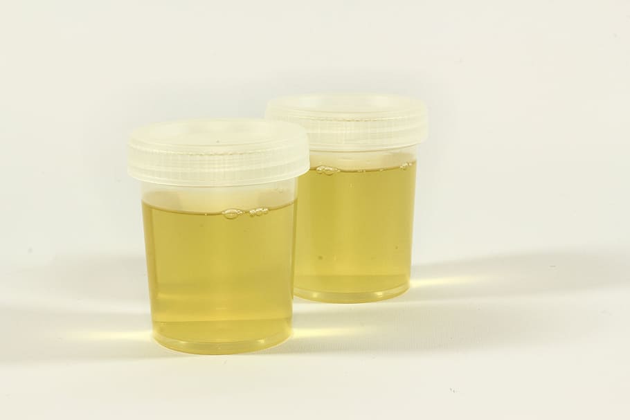Urine Photos, Download The BEST Free Urine Stock Photos & HD Images