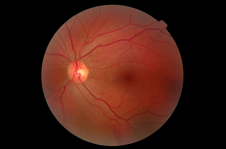 eye, fundus, close, black background, single object, no people HD wallpaper
