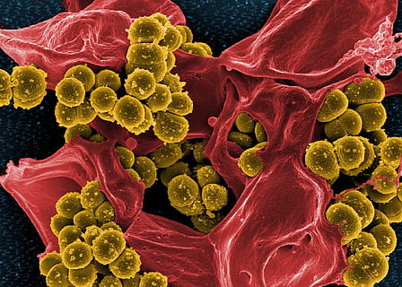 microscopic photograph of bacteria, electron microscope, stained HD wallpaper