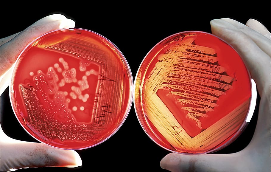 person holding two red bowls, agar, breeding ground, blood cells, HD wallpaper