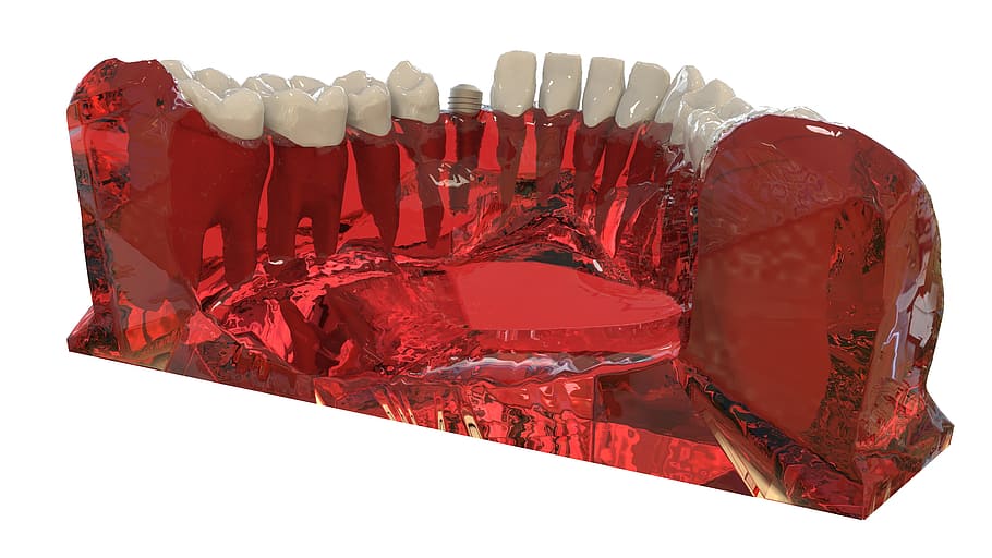 teeth, jaw, 3d model, orthodontics, the implant, red, white background