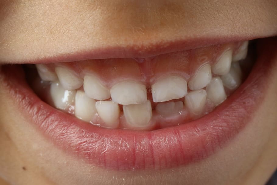 person white teeth, child smile, dental, smile teeth, tooth, hygiene, HD wallpaper