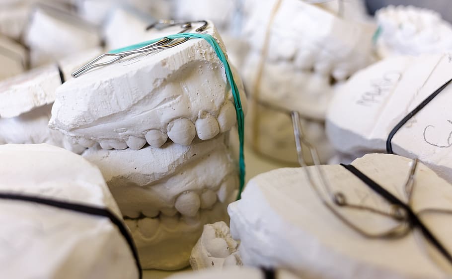 white dentures, Teeth, Models, Gypsum, Dentist, Dental, dentistry HD wallpaper