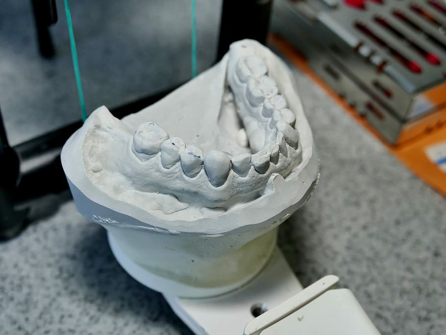 Dental, Model, Pine, Tooth, Teeth, dental model, no people HD wallpaper