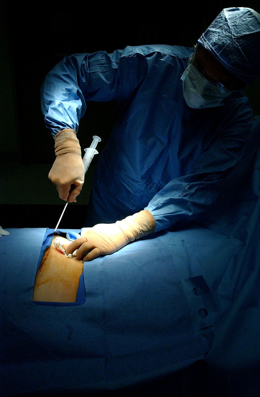 surgeon performing surgery on patient's body, operation, hospital