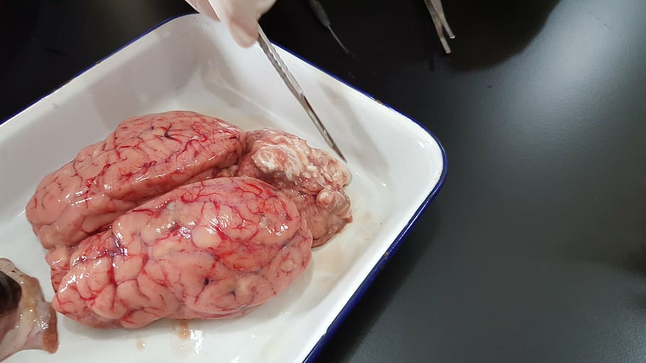 brain, organ, experiment, lab, meat, food and drink, indoors HD wallpaper