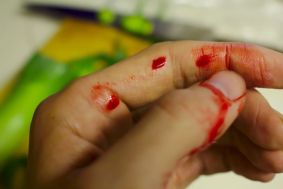 left human hand with blood, accident, bleed, bleeding, bleeding finger