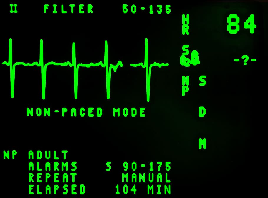heart beat reading at 84, Mode, electrocardiogram, cardiology, HD wallpaper
