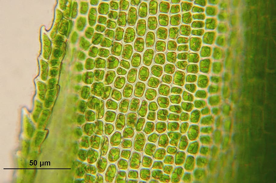 microscopic photo of green bacteria, bartramia pomiformis, cells