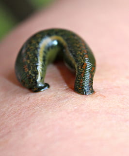 green leech on person's skin, leech therapy, medicinal leech HD wallpaper