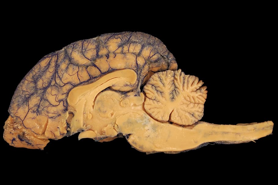hippocampus anatomy pet