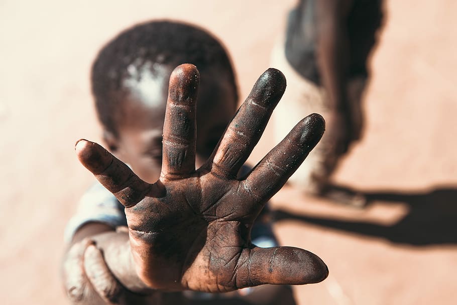 boy with black stain on hand, untitled, child, zambia, africa, HD wallpaper