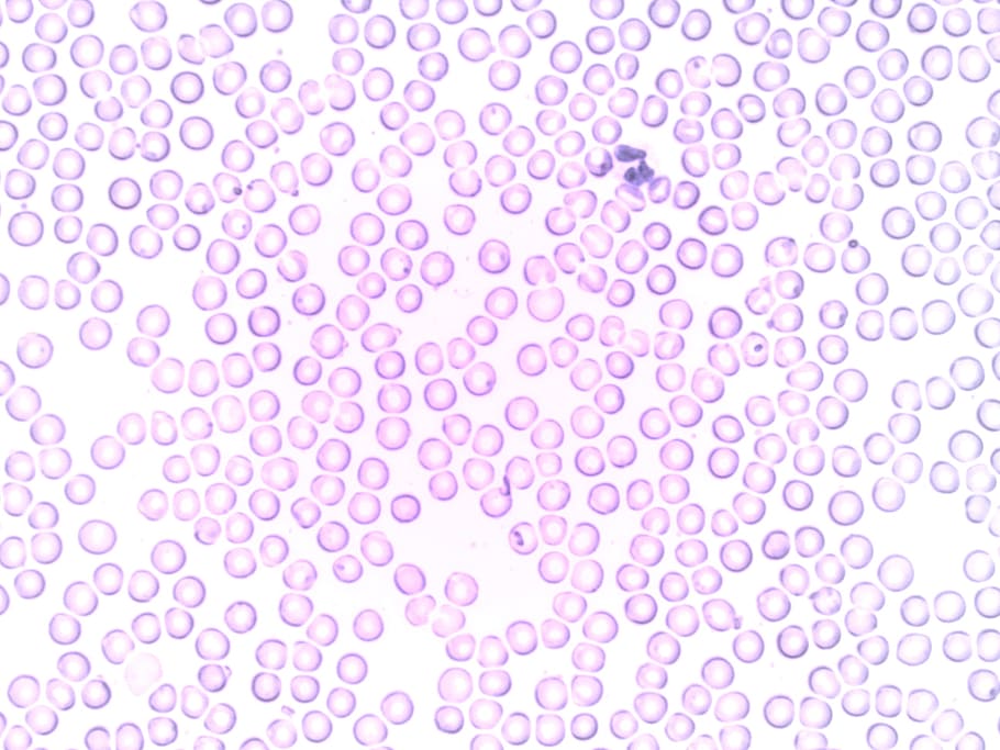 blood neutrophil segmented neutrophil granulocyte