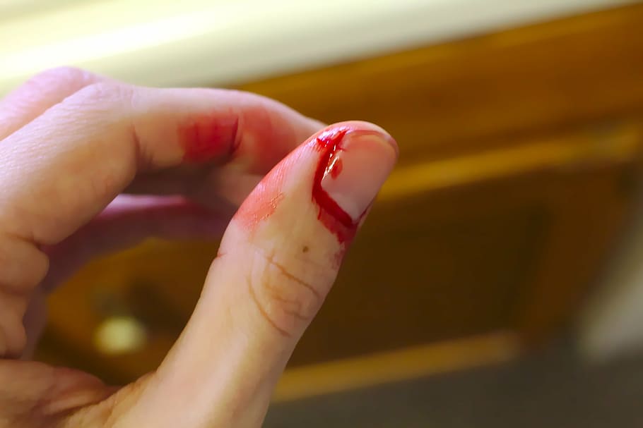 close-up photography of fingernail with blood, accident, bleed