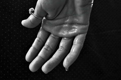 grayscale photography of person's hand wearing ring, hyperhidrosis HD wallpaper