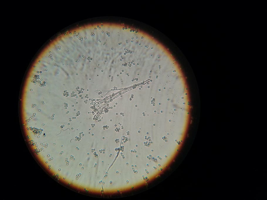 bacteria, microscope, microscopic image, indoors, education HD wallpaper