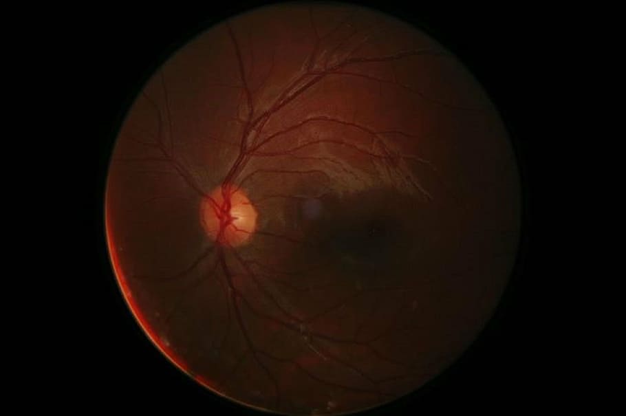 digital retinal photography, eyeball, cornea, human, biology