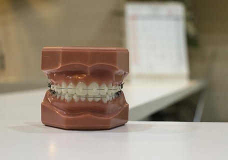 denture on white board, white and brown dental ceramic figurine HD wallpaper