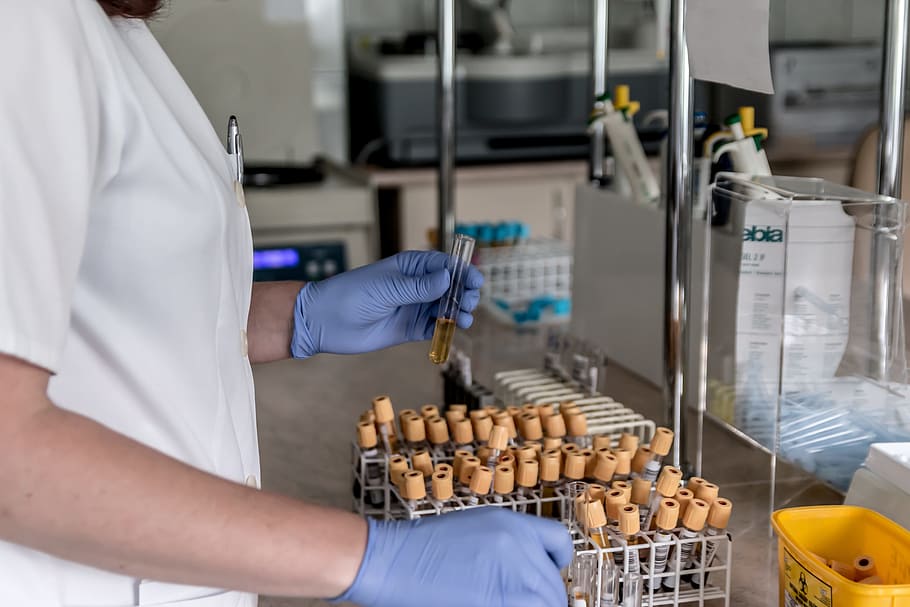 person holding glass vial, laboratory, analysis, diagnostics HD wallpaper