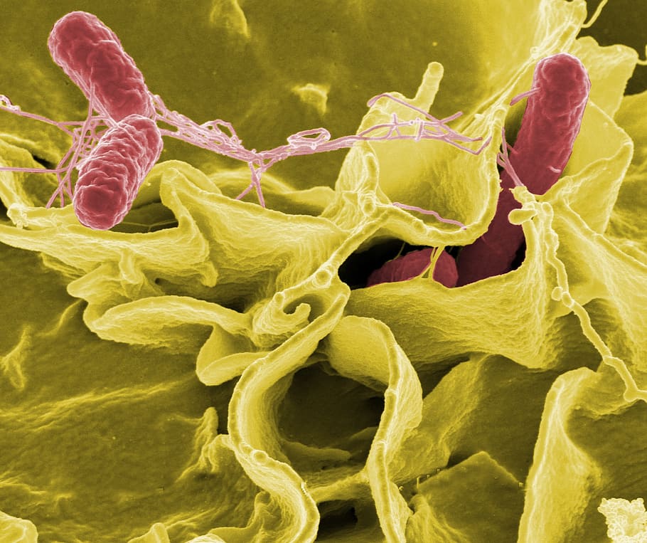 microbial photo, salmonella, bacteria, macro, electron microscope