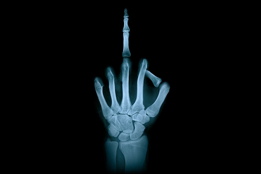hand, middle finger, x-ray radiation, finger gesture, anatomy