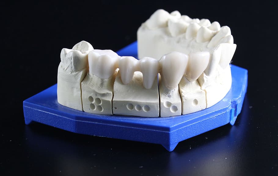 white dentures on moulder, tooth replacement, dental technician