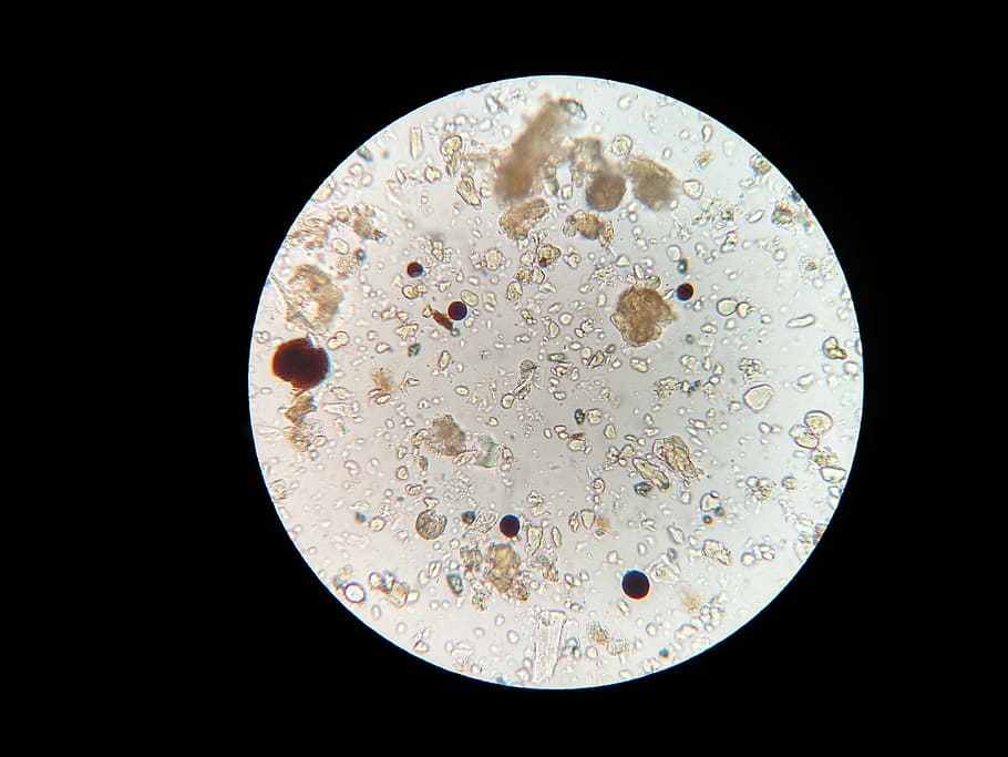 microscopic image, soil microbes, microscope, soil sample, science