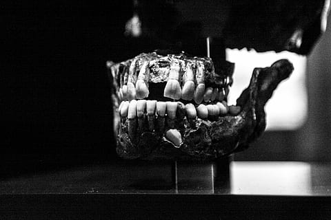 Tooth, Bone, Skull, Old, Black, Black And White, dental, mouth HD wallpaper