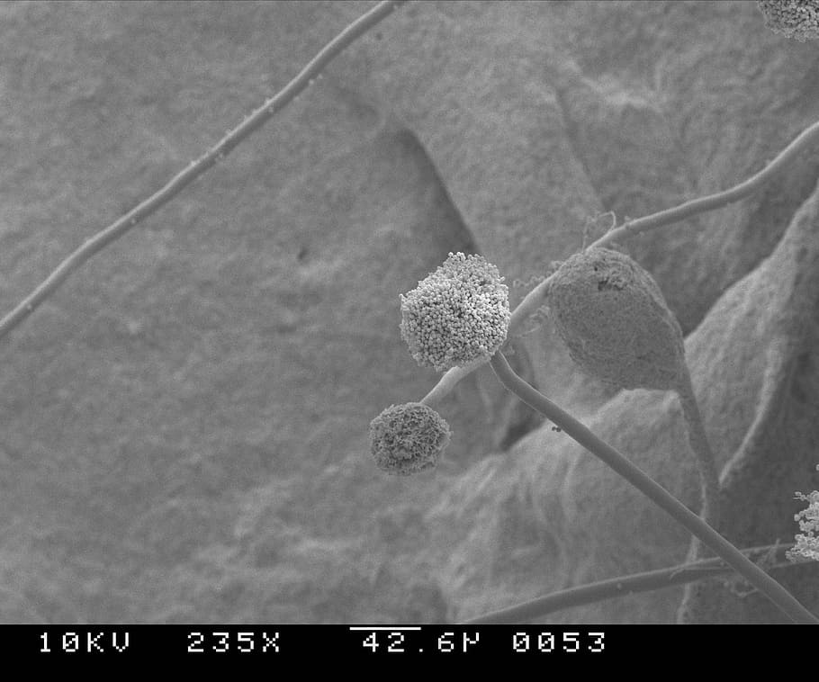mold, aspergillus, scan, 235, magnifications, fungus, microscope HD wallpaper